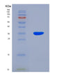 SDS-PAGE analysis of Human GNMT (Glycine N-Methyltransferase) - Recombinant Protein, showing >85% purity under 15% SDS-PAGE (Reduced)