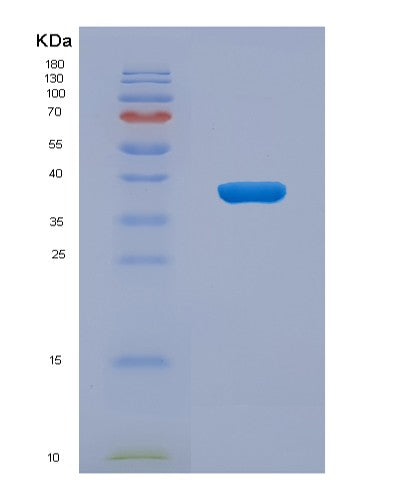 SDS-PAGE analysis of Human LASP1 (Lim And Sh3 Domain Protein 1) - Recombinant Protein, showing >95% purity under 15% SDS-PAGE (Reduced)