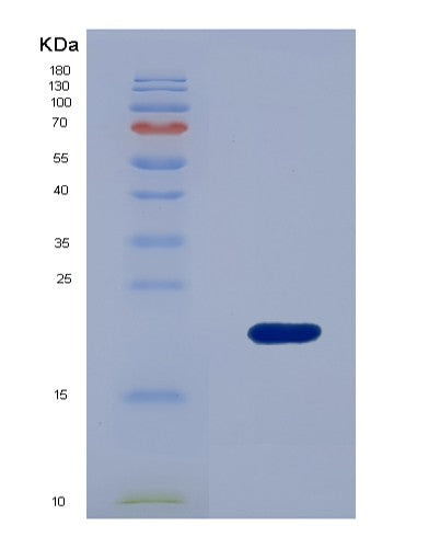 SDS-PAGE analysis of Human WTAP (Pre-Mrna-Splicing Regulator Wtap) - Recombinant Protein, showing >95% purity under 15% SDS-PAGE (Reduced)