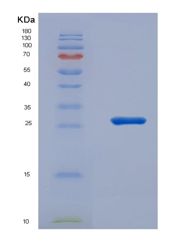 SDS-PAGE analysis of Human NCF4 (Neutrophil Cytosol Factor 4) - Recombinant Protein, showing >95% purity under 15% SDS-PAGE (Reduced)