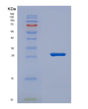 SDS-PAGE analysis of Human NCF4 (Neutrophil Cytosol Factor 4) - Recombinant Protein, showing >95% purity under 15% SDS-PAGE (Reduced)