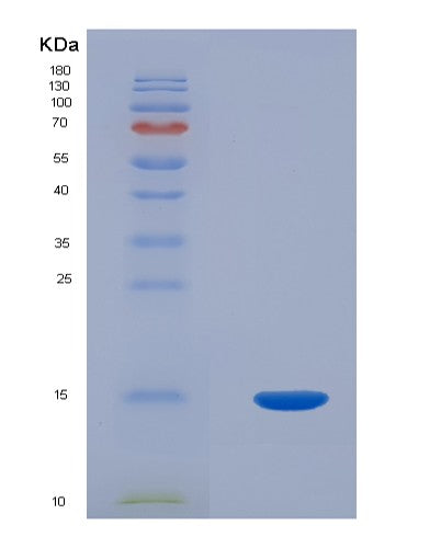 SDS-PAGE analysis of Human PCOLCE (Procollagen C-Endopeptidase Enhancer 1) - Recombinant Protein, showing >85% purity under 15% SDS-PAGE (Reduced)