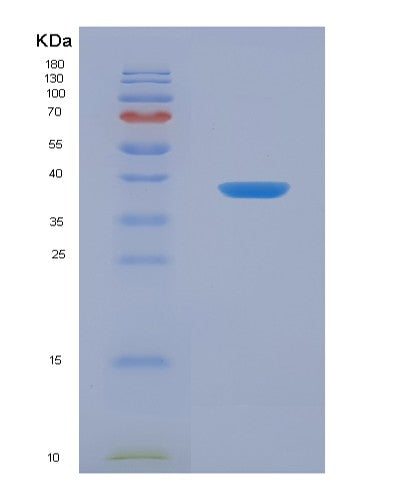SDS-PAGE analysis of Human ANKRD1 (Ankyrin Repeat Domain-Containing Protein 1) - Recombinant Protein, showing >95% purity under 15% SDS-PAGE (Reduced)