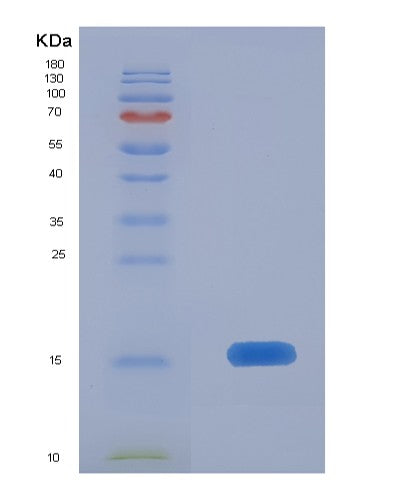 SDS-PAGE analysis of Human ELOB (Elongin-B) - Recombinant Protein, showing >85% purity under 15% SDS-PAGE (Reduced)