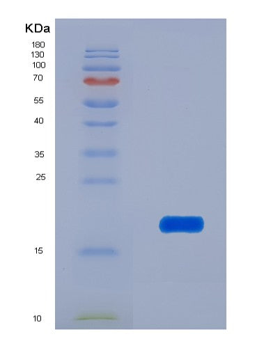 SDS-PAGE analysis of Human ANGPT1 (Angiopoietin-1) - Recombinant Protein, showing >90% purity under 15% SDS-PAGE (Reduced)