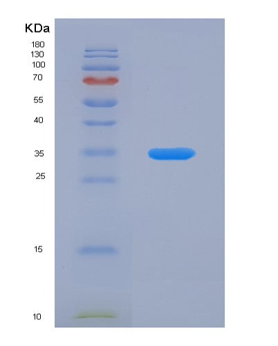 SDS-PAGE analysis of Human RSU1 (Ras Suppressor Protein 1) - Recombinant Protein, showing >95% purity under 15% SDS-PAGE (Reduced)