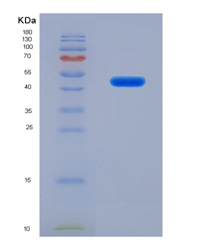 SDS-PAGE analysis of Human CYTH1 (Cytohesin-1) - Recombinant Protein, showing >95% purity under 15% SDS-PAGE (Reduced)