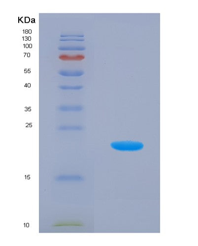 SDS-PAGE analysis of Human SHH (Sonic Hedgehog Protein) - Recombinant Protein, showing >85% purity under 15% SDS-PAGE (Reduced)