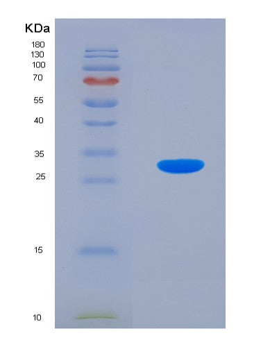 SDS-PAGE analysis of Human RGN (Regucalcin) - Recombinant Protein, showing >90% purity under 15% SDS-PAGE (Reduced)