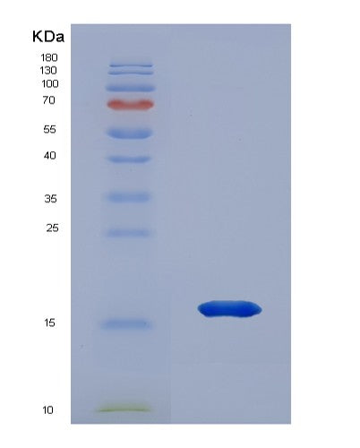 SDS-PAGE analysis of Human HMGN3 (High Mobility Group Nucleosome-Binding Domain-Containing Protein 3) - Recombinant Protein, showing >95% purity under 15% SDS-PAGE (Reduced)