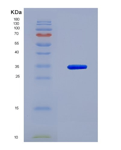 SDS-PAGE analysis of Human NFKBIB (Nf-Kappa-B Inhibitor Beta) - Recombinant Protein, showing >90% purity under 15% SDS-PAGE (Reduced)