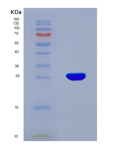 SDS-PAGE analysis of Human TPSAB1 (Tryptase Alpha/Beta-1) - Recombinant Protein, showing >90% purity under 15% SDS-PAGE (Reduced)
