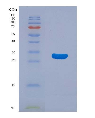 SDS-PAGE analysis of Human MAPRE1 (Microtubule-Associated Protein Rp/Eb Family Member 1) - Recombinant Protein, showing >95% purity under 15% SDS-PAGE (Reduced)