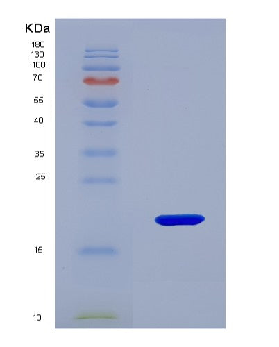 SDS-PAGE analysis of Human KISS1 (Metastasis-Suppressor Kiss-1) - Recombinant Protein, showing >85% purity under 15% SDS-PAGE (Reduced)