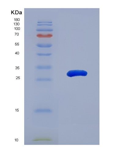 SDS-PAGE analysis of Human MAPK11 (Mitogen-Activated Protein Kinase 11) - Recombinant Protein, showing >95% purity under 15% SDS-PAGE (Reduced)