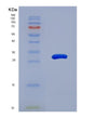 SDS-PAGE analysis of Human MAPK11 (Mitogen-Activated Protein Kinase 11) - Recombinant Protein, showing >95% purity under 15% SDS-PAGE (Reduced)
