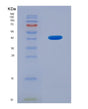 SDS-PAGE analysis of Human CHRNA6 (Neuronal Acetylcholine Receptor Subunit Alpha-6) - Recombinant Protein, showing >95% purity under 15% SDS-PAGE (Reduced)