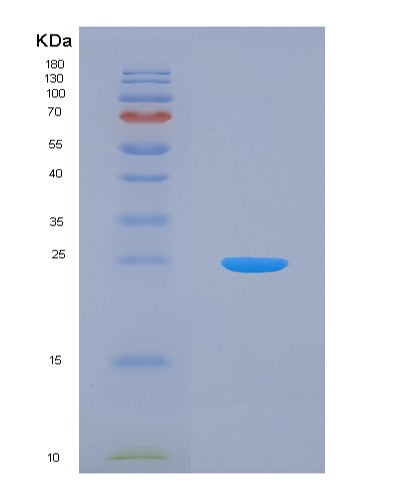 SDS-PAGE analysis of Human HSPB2 (Heat Shock Protein Beta-2) - Recombinant Protein, showing >95% purity under 15% SDS-PAGE (Reduced)