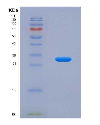 SDS-PAGE analysis of Human SGCB (Beta-Sarcoglycan) - Recombinant Protein, showing >95% purity under 15% SDS-PAGE (Reduced)