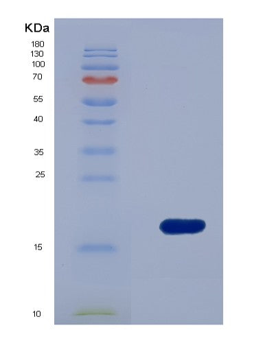 SDS-PAGE analysis of Human FSCN1 (Fascin) - Recombinant Protein, showing >90% purity under 15% SDS-PAGE (Reduced)