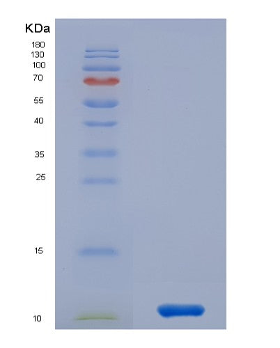SDS-PAGE analysis of Human CCL15 (C-C Motif Chemokine 15) - Recombinant Protein, showing >90% purity under 15% SDS-PAGE (Reduced)