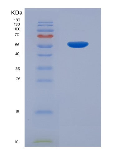 SDS-PAGE analysis of Human CDKN3 (Cyclin-Dependent Kinase Inhibitor 3) - Recombinant Protein, showing >90% purity under 15% SDS-PAGE (Reduced)