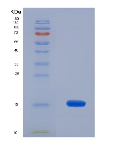 SDS-PAGE analysis of Human MIA (Melanoma-Derived Growth Regulatory Protein) - Recombinant Protein, showing >85% purity under 15% SDS-PAGE (Reduced)