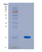 SDS-PAGE analysis of Human MIA (Melanoma-Derived Growth Regulatory Protein) - Recombinant Protein, showing >85% purity under 15% SDS-PAGE (Reduced)