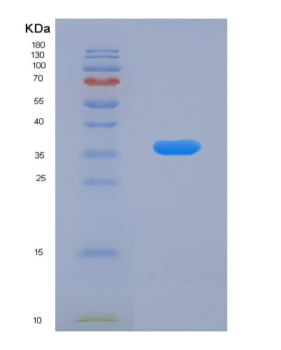 SDS-PAGE analysis of Human DUSP6 (Dual Specificity Protein Phosphatase 6) - Recombinant Protein, showing >90% purity under 15% SDS-PAGE (Reduced)