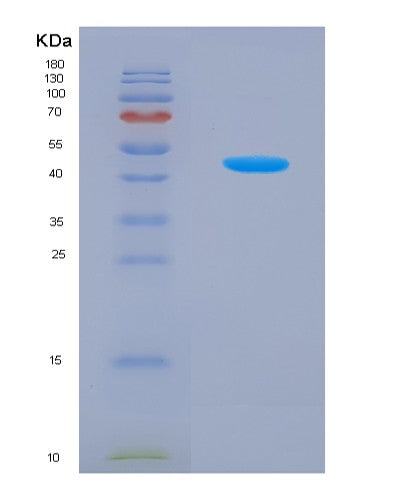 SDS-PAGE analysis of Human UPP1 (Uridine Phosphorylase 1) - Recombinant Protein, showing >85% purity under 15% SDS-PAGE (Reduced)