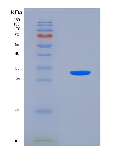 SDS-PAGE analysis of Human HADH (Hydroxyacyl-Coenzyme A Dehydrogenase, Mitochondrial) - Recombinant Protein, showing >85% purity under 15% SDS-PAGE (Reduced)