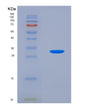 SDS-PAGE analysis of Human HADH (Hydroxyacyl-Coenzyme A Dehydrogenase, Mitochondrial) - Recombinant Protein, showing >85% purity under 15% SDS-PAGE (Reduced)