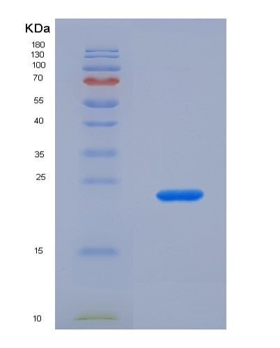 SDS-PAGE analysis of Human PTPRN (Receptor-Type Tyrosine-Protein Phosphatase-Like N) - Recombinant Protein, showing >85% purity under 15% SDS-PAGE (Reduced)