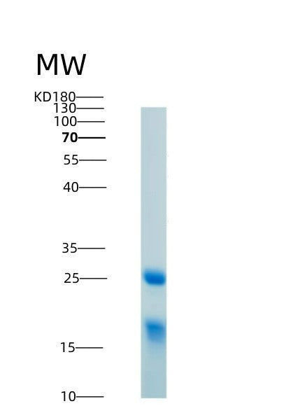 SDS-PAGE analysis of Human HMGB1 (High Mobility Group Protein B1) - Recombinant Protein, showing >95% purity under 15% SDS-PAGE (Reduced)