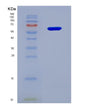 SDS-PAGE analysis of Human MICA (Mhc Class I Polypeptide-Related Sequence A) - Recombinant Protein, showing >95% purity under 15% SDS-PAGE (Reduced)