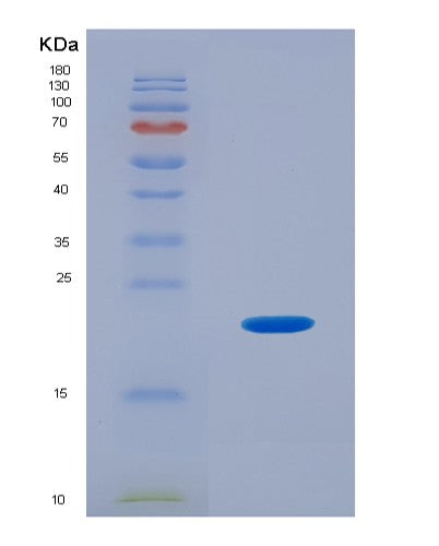 SDS-PAGE analysis of Human PHLDA2 (Pleckstrin Homology-Like Domain Family A Member 2) - Recombinant Protein, showing >85% purity under 15% SDS-PAGE (Reduced)