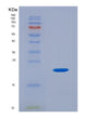 SDS-PAGE analysis of Human PHLDA2 (Pleckstrin Homology-Like Domain Family A Member 2) - Recombinant Protein, showing >85% purity under 15% SDS-PAGE (Reduced)