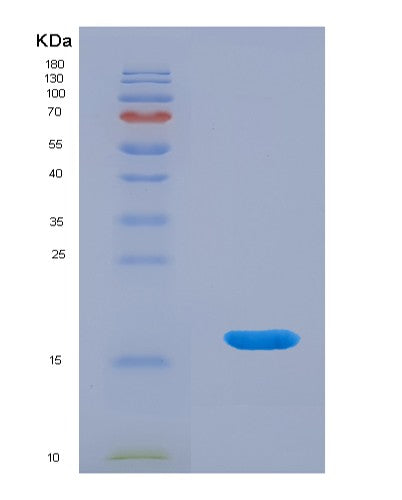 SDS-PAGE analysis of Human PLA1A (Phospholipase A1 Member A) - Recombinant Protein, showing >95% purity under 15% SDS-PAGE (Reduced)
