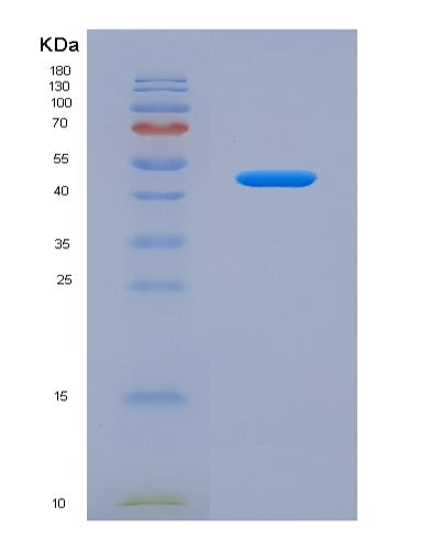 SDS-PAGE analysis of Human SFRP5 (Secreted Frizzled-Related Protein 5) - Recombinant Protein, showing >95% purity under 15% SDS-PAGE (Reduced)