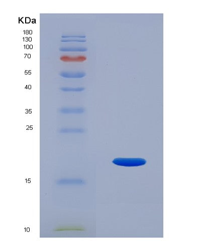 SDS-PAGE analysis of Human RNLS (Renalase) - Recombinant Protein, showing >85% purity under 15% SDS-PAGE (Reduced)