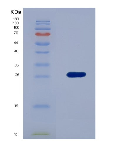 SDS-PAGE analysis of Human LAMA2 (Laminin Subunit Alpha-2) - Recombinant Protein, showing >90% purity under 15% SDS-PAGE (Reduced)