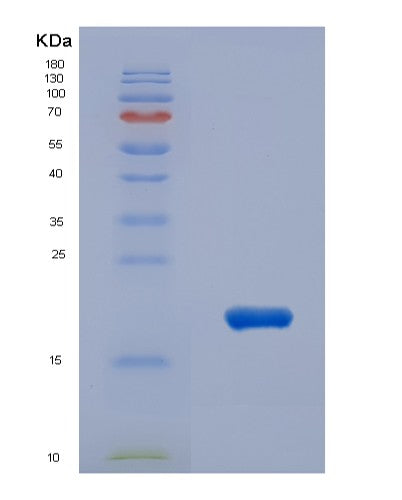 SDS-PAGE analysis of Human IL31 (Interleukin-31) - Recombinant Protein, showing >90% purity under 15% SDS-PAGE (Reduced)