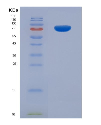 SDS-PAGE analysis of Human ETFDH (Electron Transfer Flavoprotein-Ubiquinone Oxidoreductase, Mitochondrial) - Recombinant Protein, showing >90% purity under 15% SDS-PAGE (Reduced)