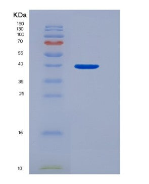 SDS-PAGE analysis of Human APIP (Methylthioribulose-1-Phosphate Dehydratase) - Recombinant Protein, showing >95% purity under 15% SDS-PAGE (Reduced)