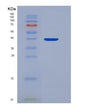 SDS-PAGE analysis of Human APIP (Methylthioribulose-1-Phosphate Dehydratase) - Recombinant Protein, showing >95% purity under 15% SDS-PAGE (Reduced)