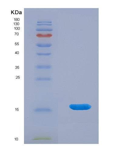 SDS-PAGE analysis of Human LAIR2 (Leukocyte-Associated Immunoglobulin-Like Receptor 2) - Recombinant Protein, showing >95% purity under 15% SDS-PAGE (Reduced)