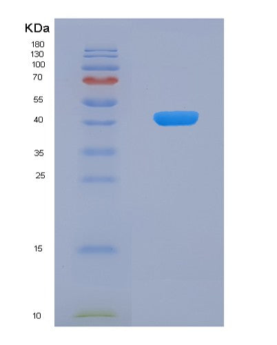 SDS-PAGE analysis of Human JMJD6 (Bifunctional Arginine Demethylase And Lysyl-Hydroxylase Jmjd6) - Recombinant Protein, showing >85% purity under 15% SDS-PAGE (Reduced)