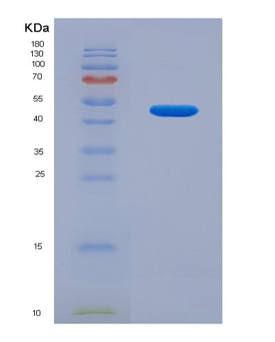 SDS-PAGE analysis of Human AAGAB (Alpha- And Gamma-Adaptin-Binding Protein P34) - Recombinant Protein, showing >95% purity under 15% SDS-PAGE (Reduced)