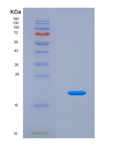 SDS-PAGE analysis of Human CPLX2 (Complexin-2) - Recombinant Protein, showing >95% purity under 15% SDS-PAGE (Reduced)