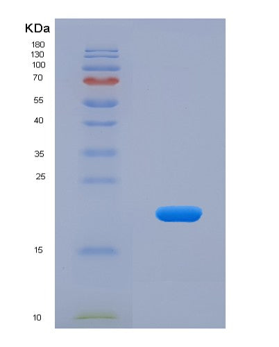 SDS-PAGE analysis of Human APOA5 (Apolipoprotein A-V) - Recombinant Protein, showing >95% purity under 15% SDS-PAGE (Reduced)